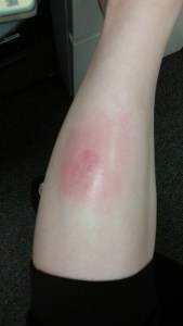 Should I be worried? I feel worried...