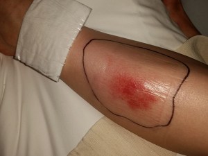 It's still gross, but it's getting better!